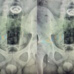 Fisiculturista baiano vice-campeão mundial morre ao sofrer infarto