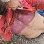 Uma pessoa morre e quatro ficam feridas em ataque a tiros no bairro Pampalona