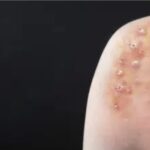 Asfalto cede e abre cratera na BR-116 entre Serrinha e Teofilândia