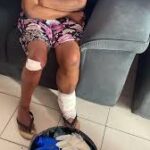 MP conclui que Orelha não morreu por agressão e pede arquivamento